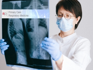 publicatie-are-smokers-protected-against-sars-cov-2-infection-covid-19-the-origins-of-the-myth